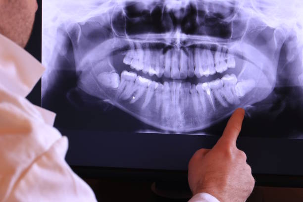 Best Emergency Denture Repair in Windsor, CA