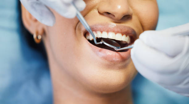 Best Pediatric Emergency Dentist in Windsor, CA