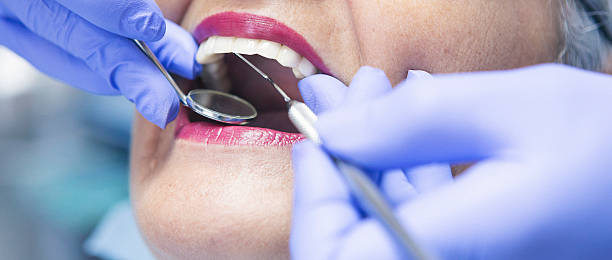 Best Pediatric Emergency Dentist in Windsor, CA